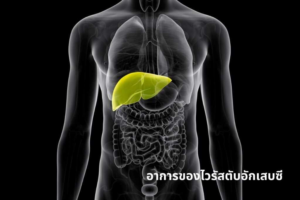 อาการของไวรัสตับอักเสบซี
