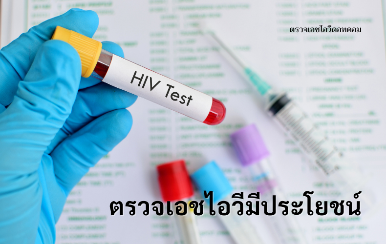 ตรวจเอชไอวี ตรวจเอดส์ โรคเอดส์ โรคติดต่อทางเพศสัมพันธ์ ซิฟิลิส การตรวจเอชไอวี วิธีตรวจเอชไอวี