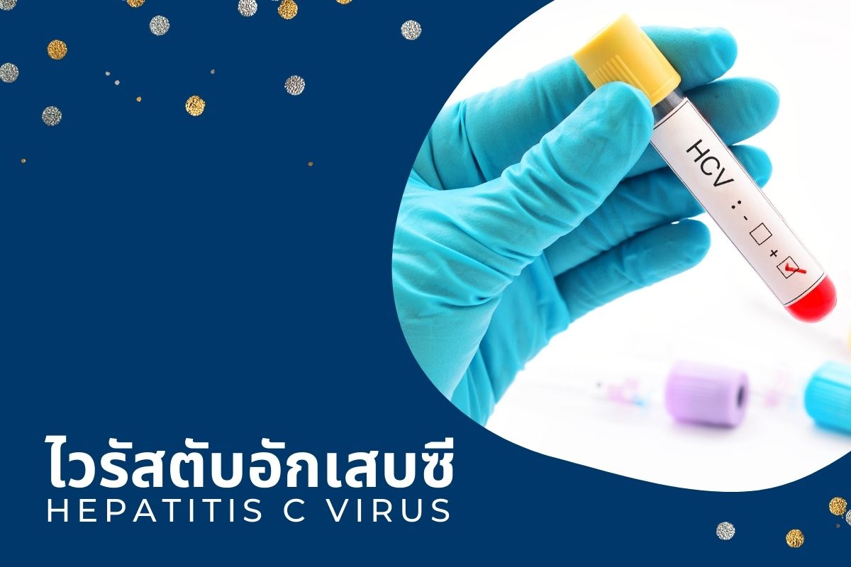 ไวรัสตับอักเสบซี (Hepatitis C Virus : HCV)