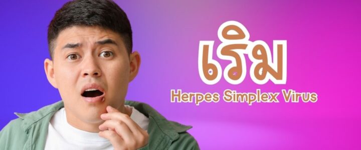 เริม Herpes Simplex Virus